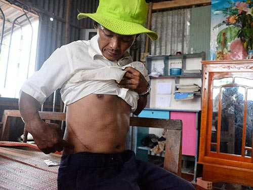 Nạn nhân mua bán thận chui ở Cần Thơ. Ảnh: NLĐ