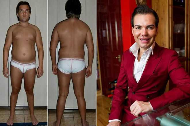 Alves là người nghiện phẫu thuật thẩm mỹ. (Nguồn: Mirror)