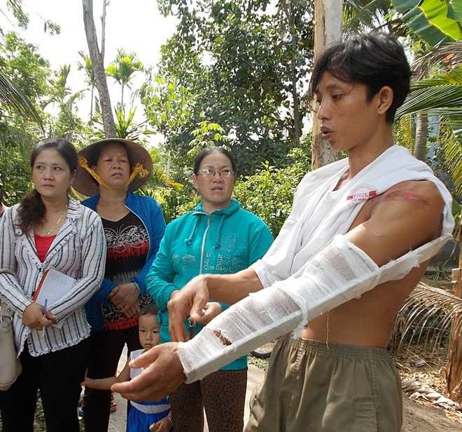 Anh Quốc với cánh tay trái bị gãy, bàng hoàng kể lại sự việc