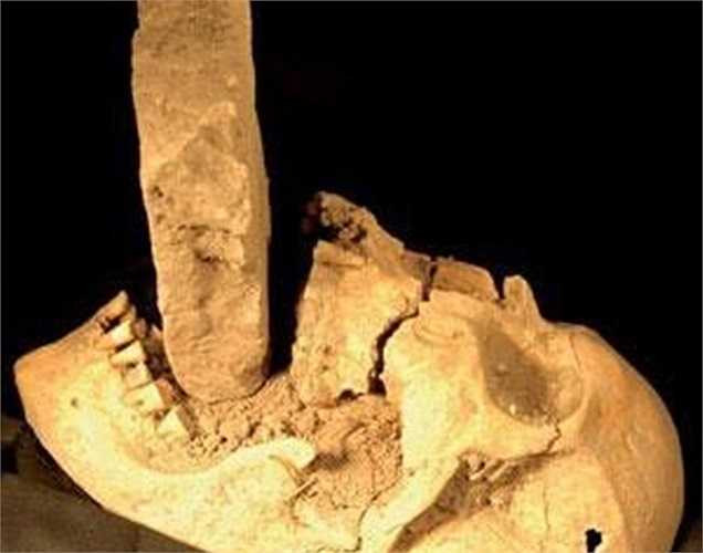 Bộ xương được đào lên từ một ngôi mộ tập thể các nạn nhân bệnh dịch hạch tại Venetian (Venice cũ) năm 1576, cho thấy viên gạch chèn vào miệng của người phụ nữ.