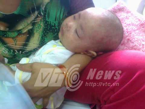 Tặng vaccine sởi và suất ăn cho bệnh nhi sởi