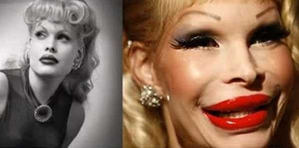 Người mẫu chuyển giới Amanda Lepore thất bại khi phẫu thuật giữ tuổi thanh xuân.