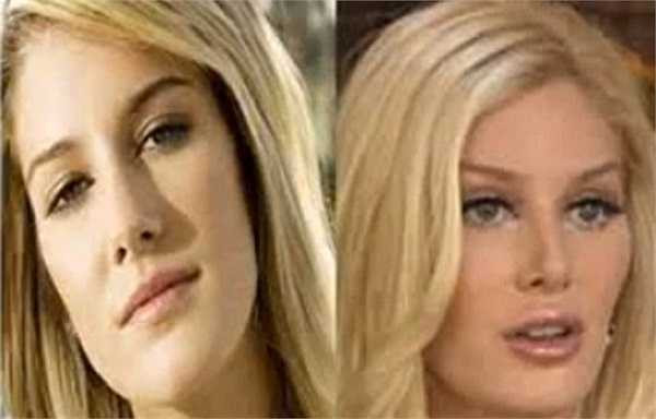 Ngôi sao truyền hình thực tế Heidi Montag hối hận khi đã mượn đến dao kéo.