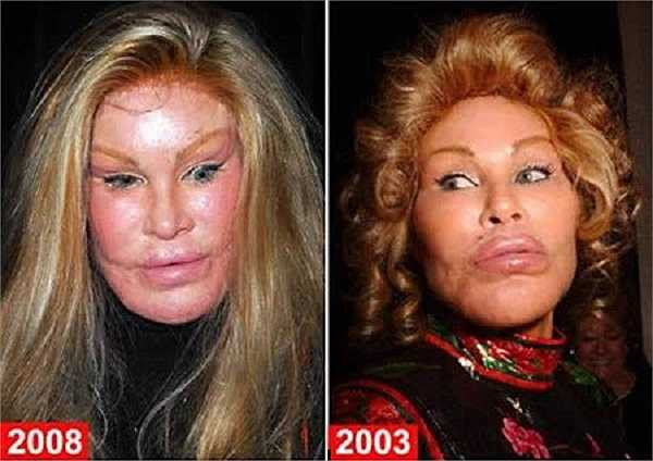 Gương mặt không thể cứu chữa của Jocelyn Wildenstein