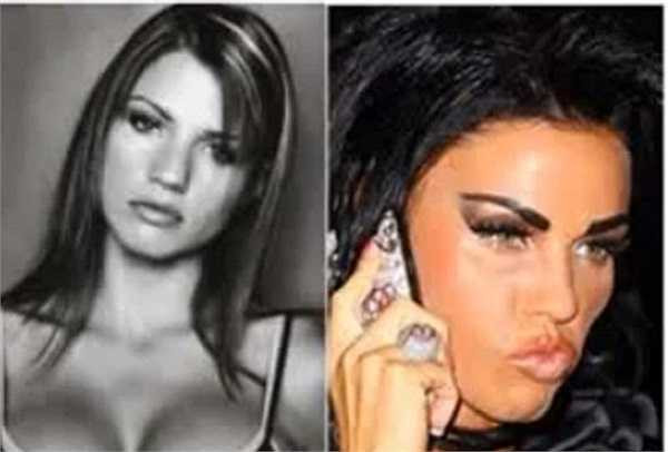 Siêu mẫu Katie Price.