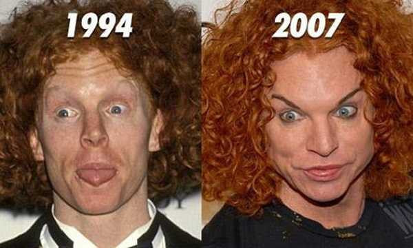 Scott Thompson biến dạng toàn bộ khuôn mặt.