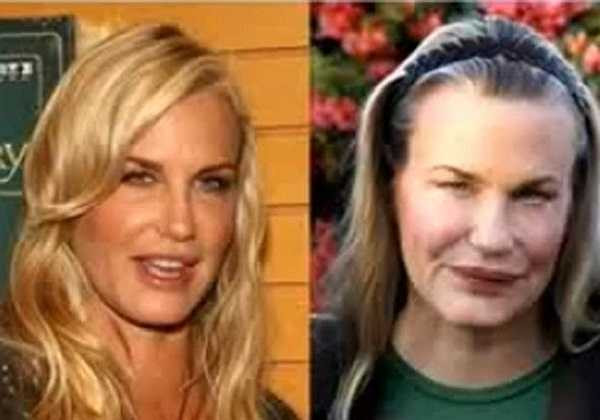 Đôi mắt nhỏ lại, đôi môi biến dạng của nữ diễn viên 51 tuổi Daryl Hannah.