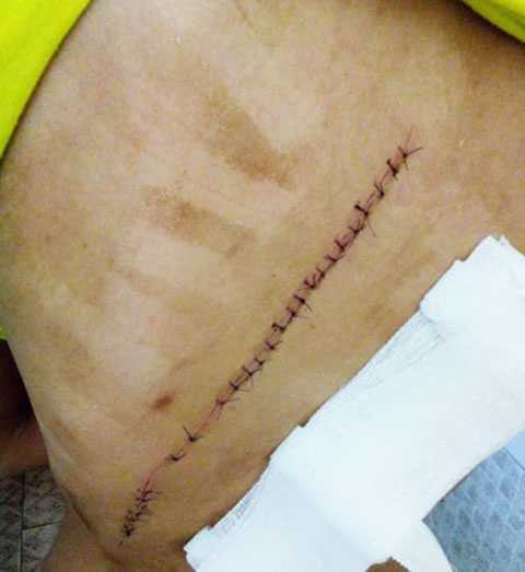 rạch lưng phụ nữ, tỉnh Khánh Hoa, Công an thị xã Ninh Hòa, Bệnh viện Đa khoa Ninh Hòa