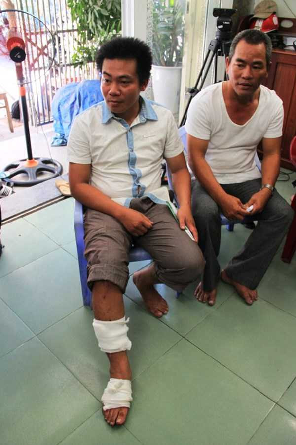 Anh Nguyễn Huỳnh Bá Biên (Thanh Khê, Đà Nẵng) -ngư dân trên tàu ĐNa 90152TS bị thương tích sau cú đâm lật, chìm tàu