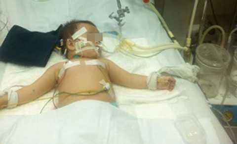 Uống nhầm dầu luyn, cháu bé nguy kịch