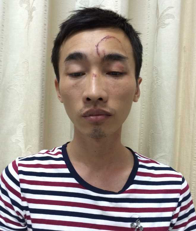 Gã trai chuyên rình phụ nữ tắm để trộm iPhone