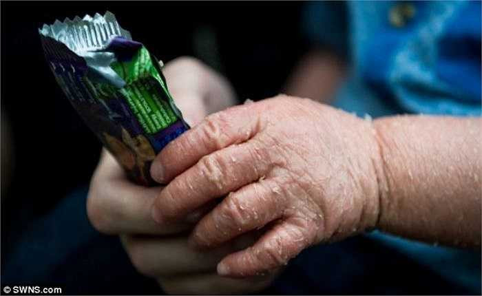 Căn bệnh của bé được cho là chỉ ảnh hưởng với tỷ lệ 1/600.000 người.