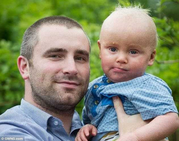 Hiện, căn bệnh của Daniel vẫn chưa tìm ra cách điều trị. Anh Steve Maples, cha của bé, hy vọng con trai lớn lên sẽ tự chăm sóc được cho bản thân.