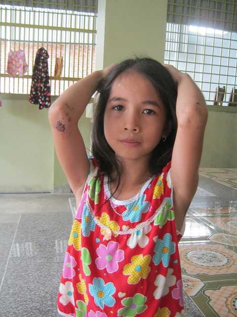 Vật lộn 2 giờ dưới giếng sâu, bé gái thoát cửa tử