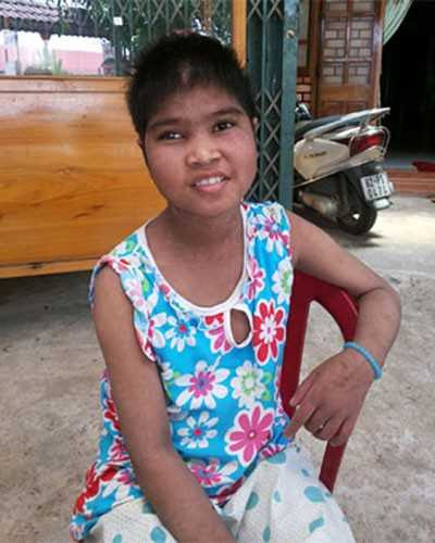  Y Nôn khi được cấp cứu và Y Nôn tươi tỉnh, bắt đầu trở lại bình thường sau khi được cứu chữa.