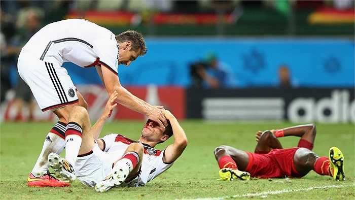 Thomas Muller thậm chí đã đổ máu nhưng vẫn không thể có bàn thắng thứ 4 tại World Cup 2014 cho riêng mình