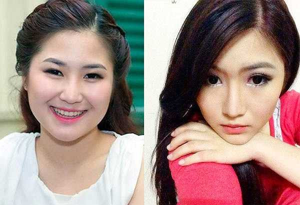 Sau khi một đoạn clip quay cảnh dao kéo bị phát tán trên mạng vào tháng 3/2014, dưới áp lực dư luận về sự thay đổi bất thường của gương mặt thon gọn, đặc biệt là chiếc mũi cao, thanh tú khác thường, Hương Tràm thú nhận mình đã chỉnh mũi nhằm có được diện mạo hoàn hảo hơn khi xuất hiện trước công chúng.