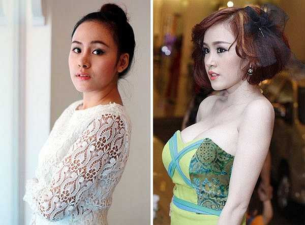 Sau hai lần nâng ngực tại Thái Lan và Việt Nam, vòng 1 của hot girl Huyền Anh bị lệch, cứng nên cô quyết định đặt lại bằng túi gel 3D. Tuy chi khoảng 5.000-6.000 USD (100-120 triệu đồng) cho lần dao kéo thứ ba này nhưng cô vẫn không được đánh giá cao về ngoại hình bởi vòng 1 quá khổ, thiếu tự nhiên.