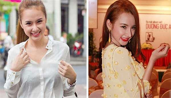 'Bà mẹ nhí' Angela Phương Trinh tiết lộ cô đã chi 35 triệu để nâng mũi bằng sụn tai. Tuy nhiên phần đỉnh mũi nhô ra quá nhiều khiến khuôn mặt người đẹp trở nên khó coi. Mỹ nhân cho hay: 'Tôi được bác sĩ gây mê và ngủ một giấc dài, chừng 2 giờ. Khi tỉnh dậy thì mọi việc đã xong rồi nên hầu như không có cảm giác đau đớn gì'.