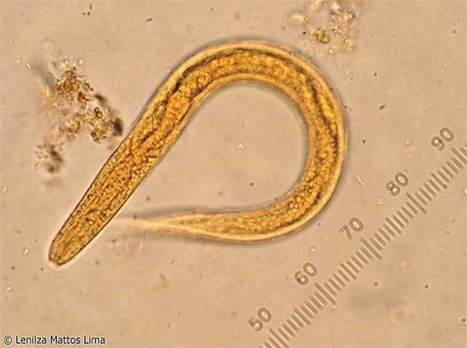  Giun lươn là một loại giun tròn nguy hiểm nhất trong các loại ký sinh trùng đường tiêu hóa ở người vì chúng có thể tự nhân lên trong cơ thể (do quá trình tự nhiễm). 