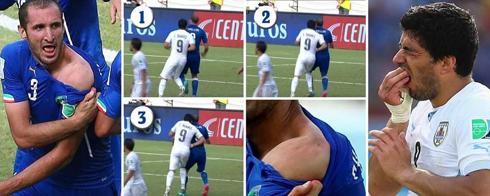 Vụ việc Suarez cắn Chiellini đang diễn biến rất phức tạp