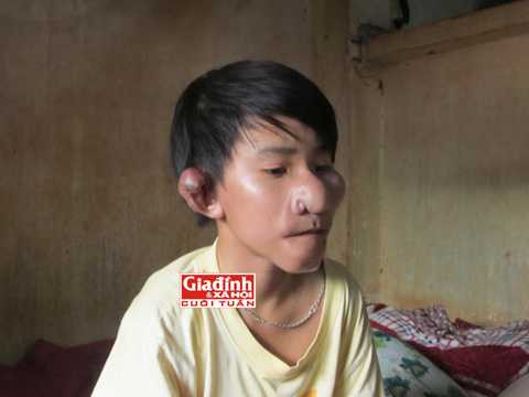 Trư Bát Giới, Bẹnh viện Đa khoa Bà Rịa - Vũng Tàu, Bệnh viện Nhi Đồng 2, TP. HCM 