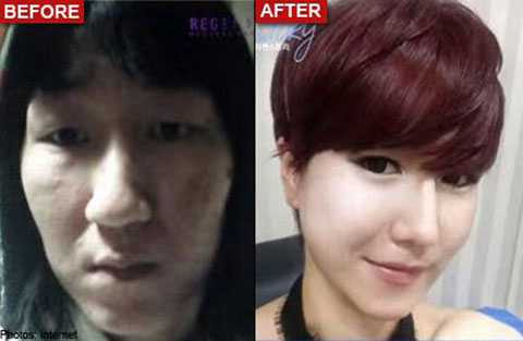 'Người có khuôn mặt bà già' bất ngờ trẻ và xinh hơn