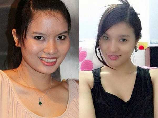 Để cải thiện nhan sắc, Lê Thị Phương đã hai lần sửa mũi và thu gọn cằm cũng như làm lại răng. Kết quả sau những ngày đau đớn vì dao kéo là khuôn mặt thon gọn, thanh thoát, Lê Thị Phương từ đó cũng đắt show thời trang, chụp ảnh.