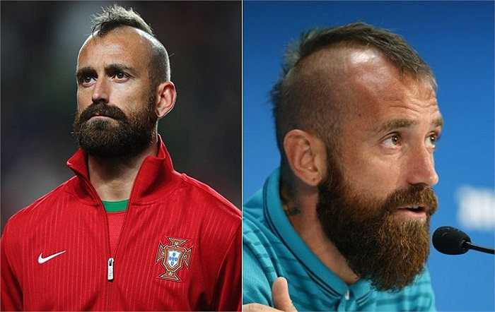 Raul Meireles với cái đầu chỉ đúng một đường tóc, trong khi râu ria lại 'cực kì tươi tốt'.