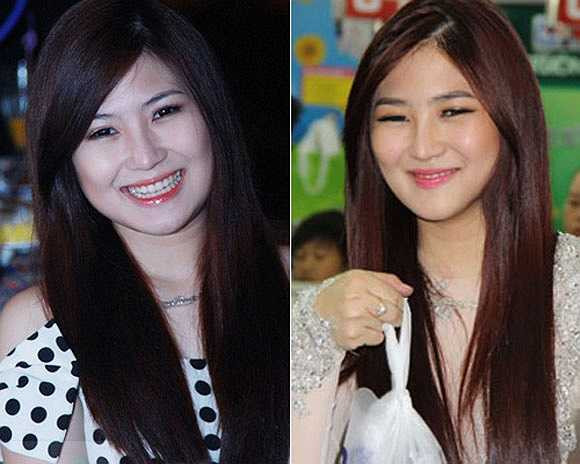 'Còn về video ở phòng phẫu thuật, sự thật là lúc đó tôi đang ở trong tình trạng ngấm thuốc gây mê nên không biết gì'