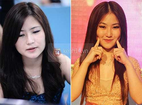 'Tôi cho rằng, thẩm mỹ là chuyện rất bình thường trong thời buổi bây giờ.'