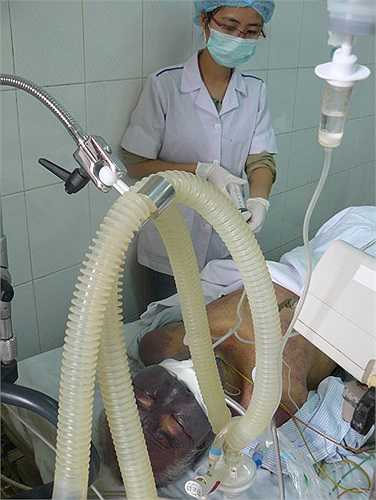 Bệnh nhân bị suy đa phủ tạng thì khả năng tử vong chiếm tỷ lệ 45%- 50%.