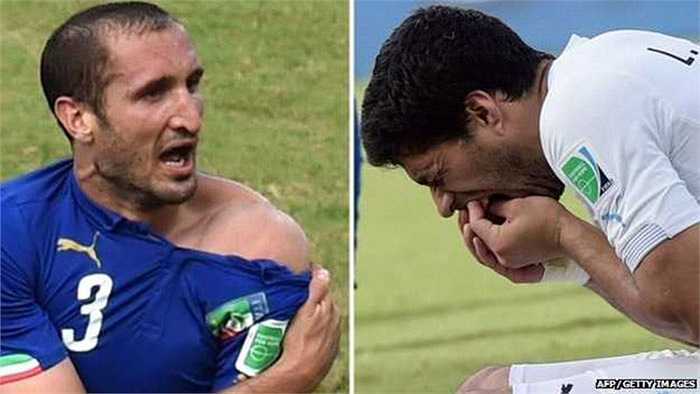 Luis Suarez chính thức được trao biệt hiệu 'răng thủ' sau khi cắn vào vai Chiellini - lần thứ 3 anh này động răng trong sự nghiệp