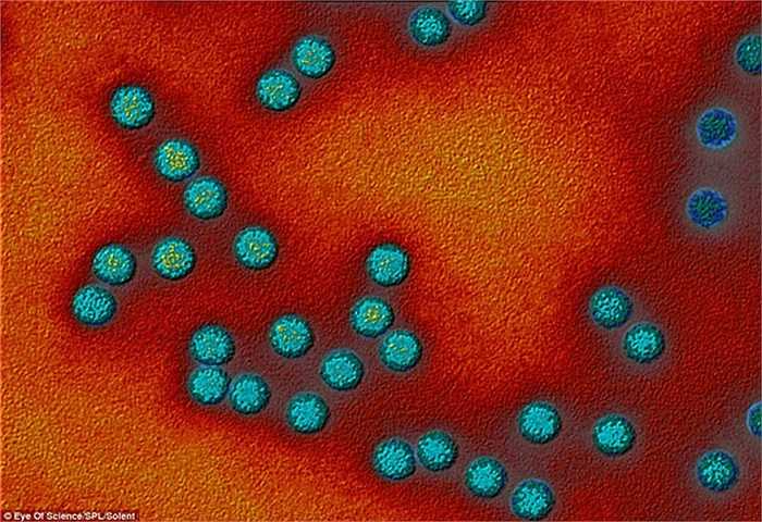 Loại vi khuẩn trong dạ dày này có tên gọi là Helicobacter pylori.