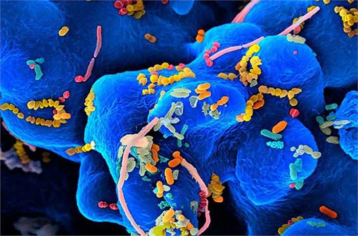 Loài vi khuẩn Microbe.