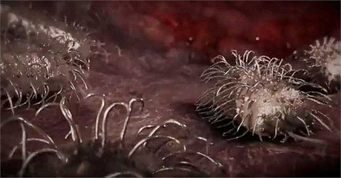 Cận cảnh vi khuẩn ăn thịt khiến nhiều người bị mất cả tay, chân, thậm chí tính mạng.