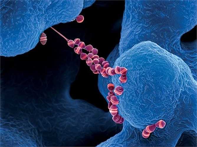 Liên cầu khuẩn Streptococcus có hình dạng giống như một chuỗi vòng đa sắc