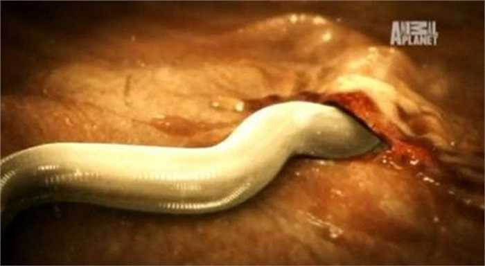 Giun móc dùng hai chiếc răng to cắm chặt vào da, lần theo những vết thương mở và xâm nhập vào cơ thể con người. Giun móc sống bằng cách hút máu trong cơ thể con người làm người bệnh có triệu chứng thiếu máu, thiếu sắt. 