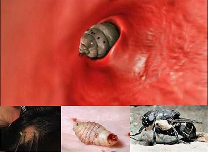 Ấu trùng ruồi botfly làm ổ dưới da người và hút máu dưới da của vật chủ qua vết đốt của vật trung gian hoặc là qua lỗ chân lông. Chỗ chúng làm ổ sẽ sưng tấy, tiết ra mủ và dịch gây đau nhức. 