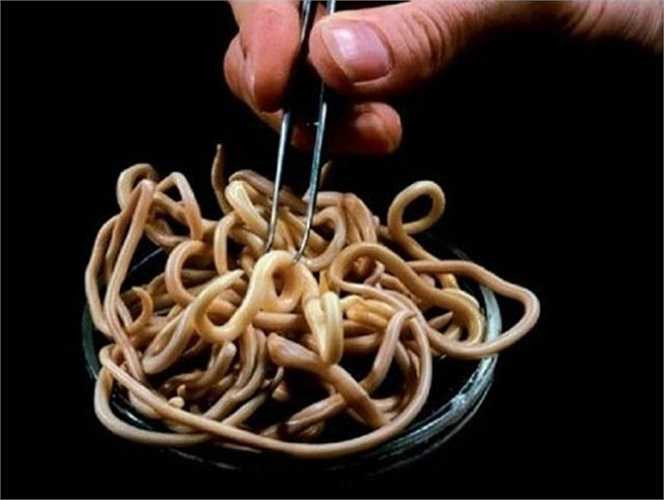 Giun đũa ký sinh trong tuyến ruột của con người. Nó có thể phát triển và dài tới 15-35 cm. Giun đũa lây lan qua đường tiêu hóa. Các triệu chứng: sốt, mệt mỏi, dị ứng, phát ban, nôn, tiêu chảy, các vấn đề về thần kinh, thở khò khè và ho. 