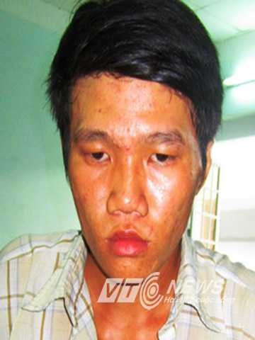 Bé gái 12 tuổi khai bị thầy giáo và phụ xe tải hiếp dâm