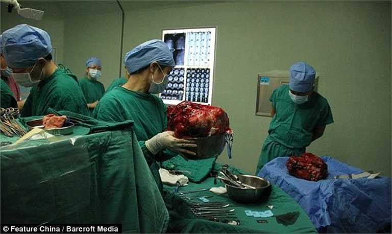 Cả gia đình phải tìm một bệnh viện lớn cách nhà hơn 4000 km để tiến hành phẫu thuật cho cô bé. Mức chi phí ban đầu cho ca phẫu thuật là hơn 300 triệu đồng.