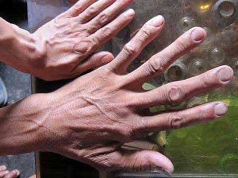  Đôi bàn tay to lớn của ông Chính, bên cạnh là tay vợ ông.