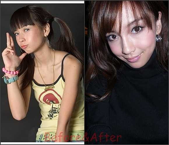 Angela Baby là một trong những mỹ nhân Hoa ngữ thường xuyên bị đặt nghi án về phẫu thuật thẫm mỹ. Khuôn mặt của cô thay đổi gần như hoàn toàn so với trước trước khi ra mắt.