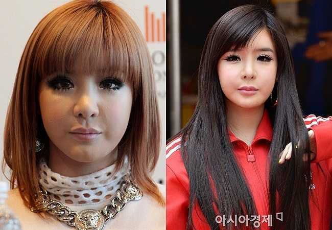 Park Bom thường xuyên dính nghi án tiêm botox. Cô bị cho rằng lạm dụng rất nhiều kỹ thuật thẩm mỹ này để khuôn mặt luôn căng đầy. 