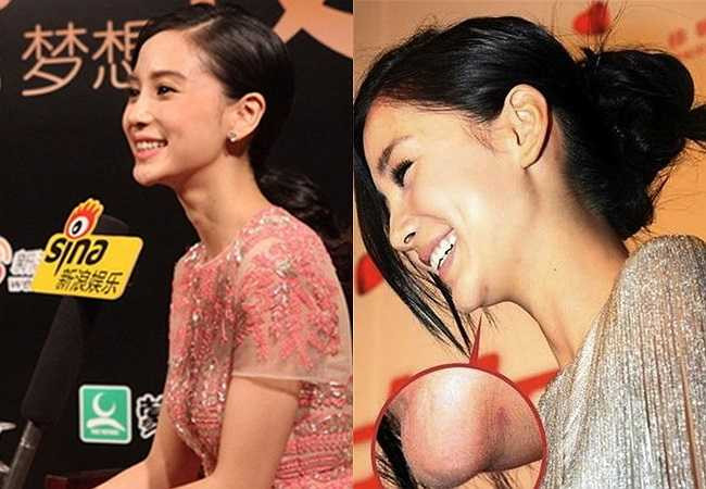 Angela Baby để lộ vết sẹo ở cằm dễ nhận biết.