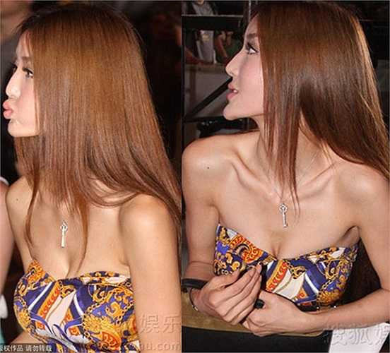 Lý Dĩnh Chi cũng là mỹ nhân Hoa ngữ nổi tiếng với chiếc cằm biến dạng do phẫu thuật thẩm mỹ. 