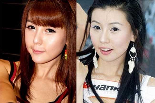 Lee Ji Woo là một trong những người mẫu nóng bỏng cùa Hàn Quốc. Cô cũng 'đại tu nhan sắc' khá nhiều lần, đặc biệt nhất là chiếc cằm. 