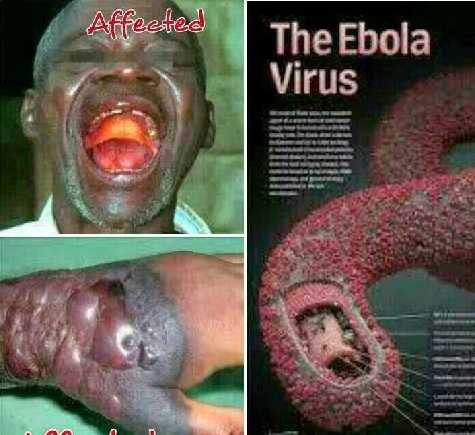 Nỗi kinh hoàng từ vi rút Ebola - đại dịch mới của thế giới