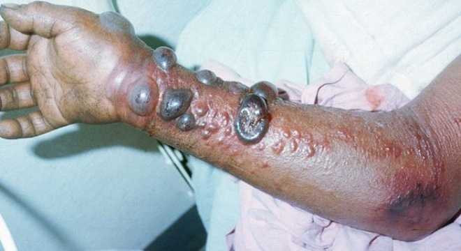 Thế giới 24h: Ebola 'khát máu' đang đe dọa loài người